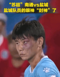 img, 左脸的胎记 img, 左脸的胎记